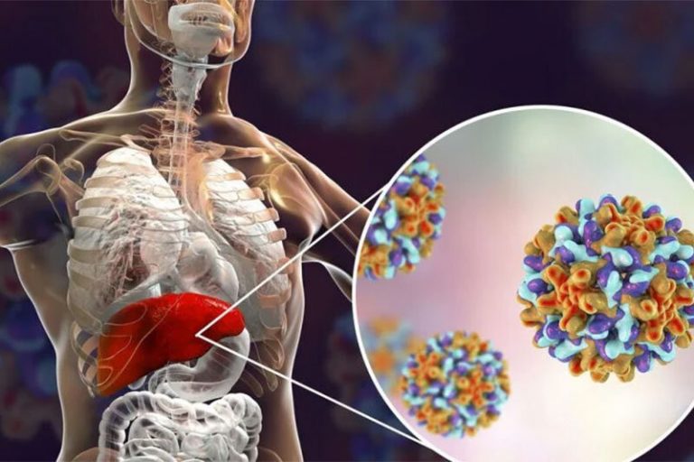 اینفوگرافیک | علائم هپاتیت و راههای انتقال آن
