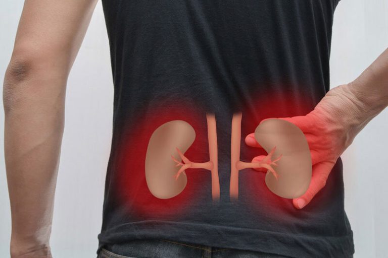 اینفوگرافیک | چرا کلیهها درد میگیرند؟