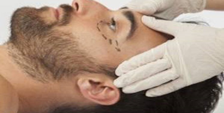 شبکههای اجتماعی چطور برای جراحی زیبایی مشتاقتان میکند؟