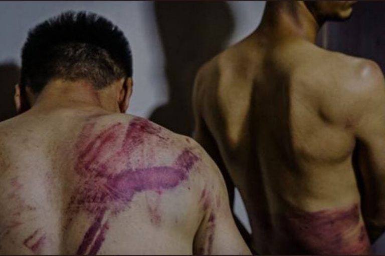 عکس | تنبه شدید خبرنگاران بازداشتی در تظاهرات کابل