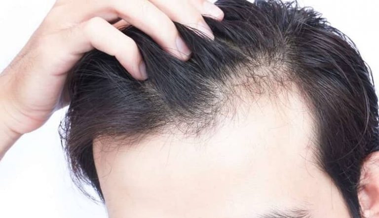 چه بخوریم تا ریزش مو نگیریم؟