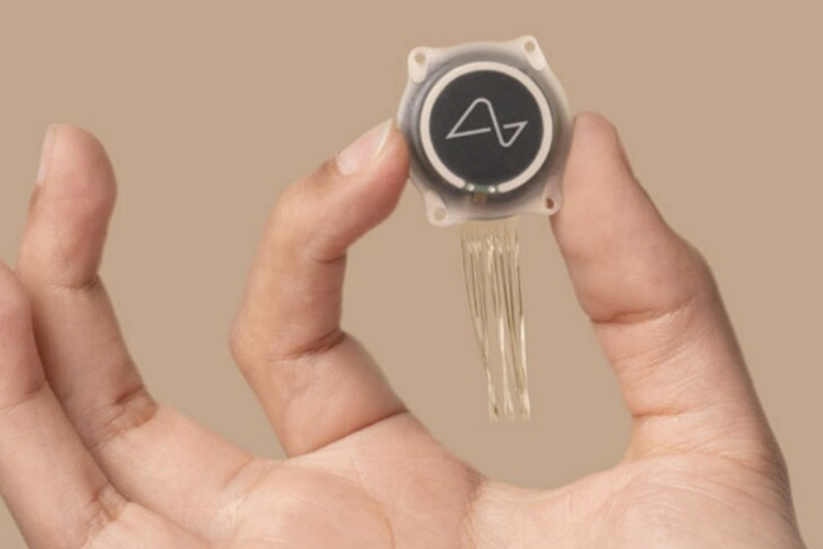 اولین دریافت کننده تراشه مغزی چگونه زندگی میکند؟