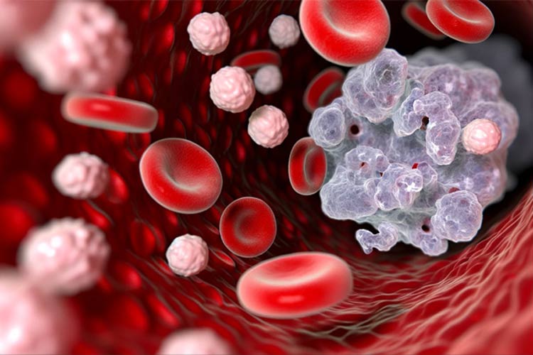 نیمی از مرگومیرهای ناشی از سرطان با ایجاد تغییر در سبکزندگی قابل پیشگیری است