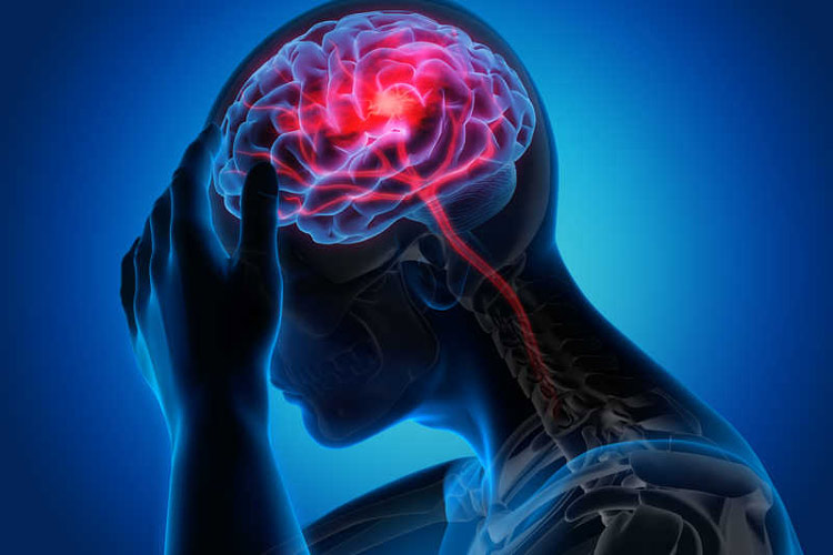 ۸ راهکار اساسی برای پیشگیری از سکته مغزی
