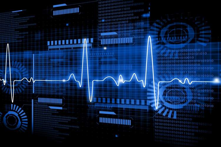 هوش مصنوعی و تحول در تشخیص بیماریهای قلبی: نوآوریهای جدید در تحلیل نوار قلب (ECG)