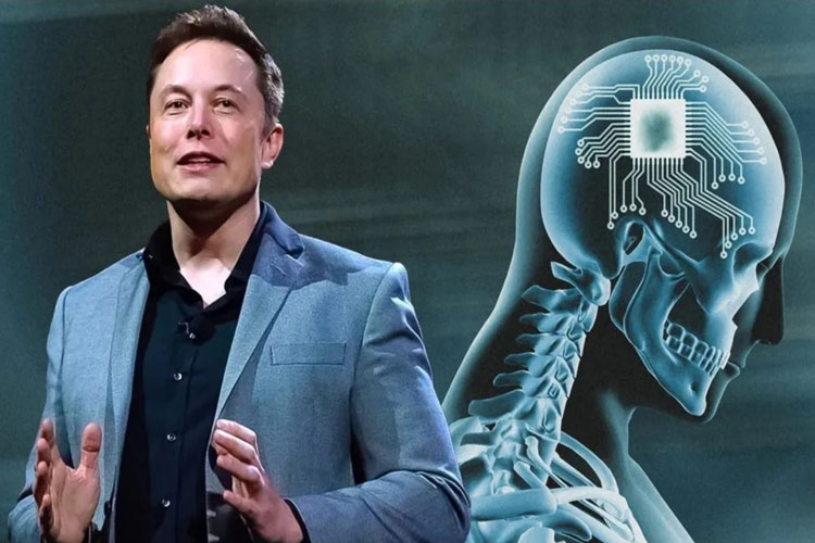 کاشت تراشه مغزی نورالینک:: دستاوردی انقلابی در درمان آسیب‌های عصبی