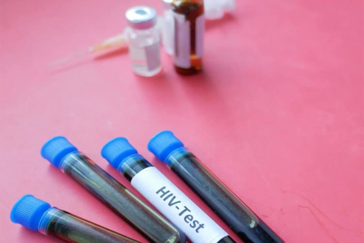 داروی پیشگیری از ایدز از دو سال دیگر عرضه میشود