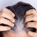 یافتهای جدید درباره سفید شدن مو
