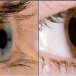 آیا استفاده مداوم از موبایل و لپتاپ باعث قوز قرنیه میشود؟