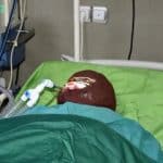 اسیدپاشی هولناک روی پدر و دختر