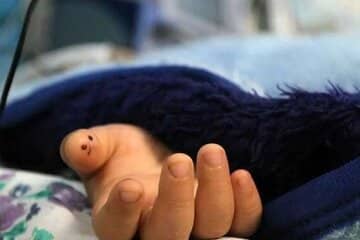 ماجرای مرگ کودک ۴ساله/ خانواده ادعا کردهاند؛ کودک از بالای درخت افتاده، اما کادر درمان از کودک آزاری خبر میدهند