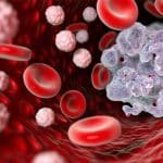 ۴ نشانه عجیب سرطان که هرگز نباید نادیده بگیرید