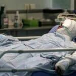 اعلام آمار سالانه سوختگی در ایران/ چند نفر از مصدومان فوت میشوند؟