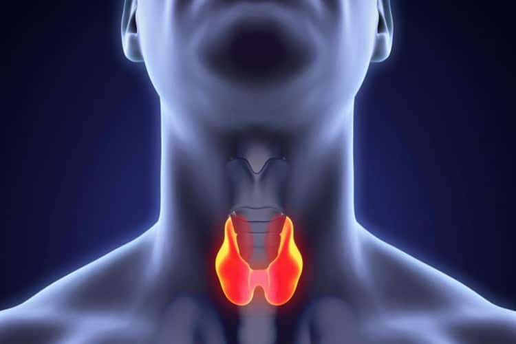 درمان سرطان تیروئید: از تشخیص زودهنگام تا رویکردهای کمتهاجمی نوین