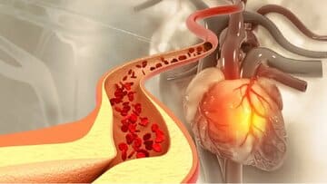 کاهش کلسترول، بدون نیاز به دارو/ چربیهای کاهنده کلسترول کدامند؟/ این ورزشها موثرند