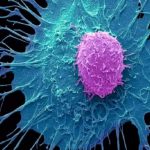 رمز تازه فرار سلولهای سرطانی