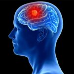 فناوری شگفتانگیز در مغز انسان؛ دستگاهی برای شناسایی تومورهای سرطانی