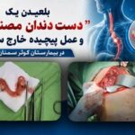 انجام موفق عملیات جراحی پیچیده  بازکردن مری و خارج کردن دندان مصنوعی در بیمارستان کوثر سمنان